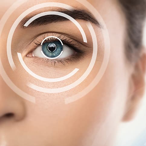 Primo piano ravvicinato di un occhio azzurro femminile con cerchi grafici bianchi e concentrici sovrapposti, a simboleggiare la precisione della diagnostica e i benefici visivi della chirurgia laser per la miopia.
